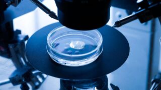 ivf.jpg