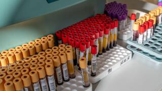 Moscow, Russia - Oct 25. 2019. The BD Vacutainer tubes from Becton Dickinson International with patient blood