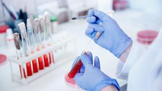 Woman medic working with blood sample in laboratory, blue color