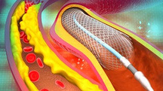 heartstent-adobe-crystal.jpg