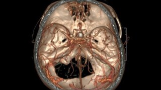GE Healthcare brain image from co media gallery 575x375.jpg